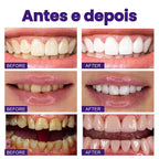 Blanqueador Dental iziSmile - Dientes Blancos en Segundos [Descuento + Entrega Gratis Hoy]