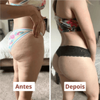 Lymphatische Massagegerät für Lipödem und Cellulite MännerRaum