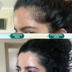 Masajeador Eléctrico para Cuero Cabelludo - Renova Hair