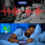 NeoVita® Protector Bucal Ajustable Anti-Ronquido